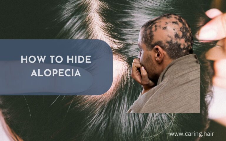 How to Hide Alopecia Tips and Tricks for Covering Bald Spots